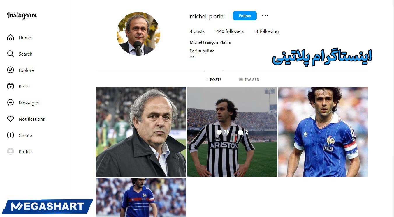 اینستاگرام پلاتینی - مگاشرط اینستاگرام پلاتینی