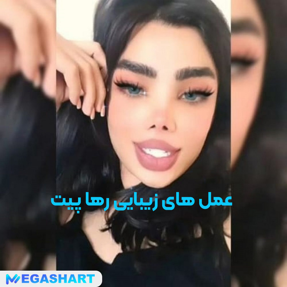 عمل های زیبایی رها پیت - مگاشرط عمل های زیبایی رها پیت