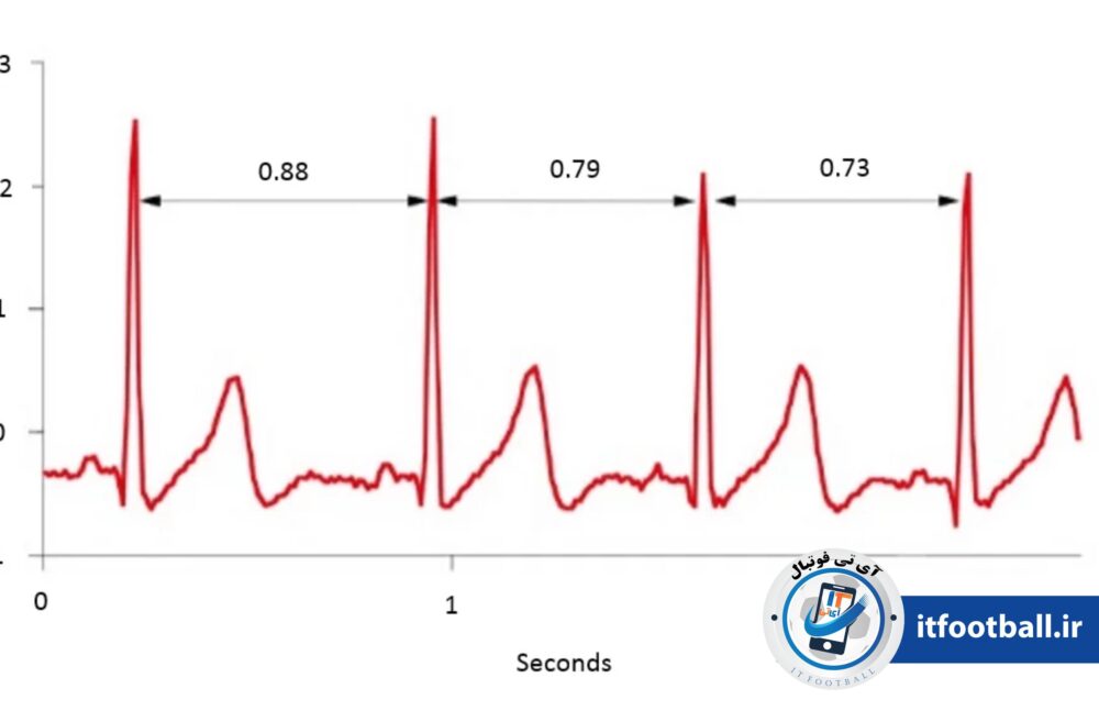 ضربان قلب
آی تی فوتبال